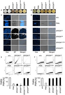 Inert Coats of Magnetic Nanoparticles Prevent Formation of Occlusive Intravascular Co-aggregates With Neutrophil Extracellular Traps